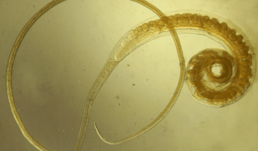 Vlasov Tricocephalie